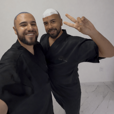 Como é quanto custa fazer um transplante de cabelo em 2026