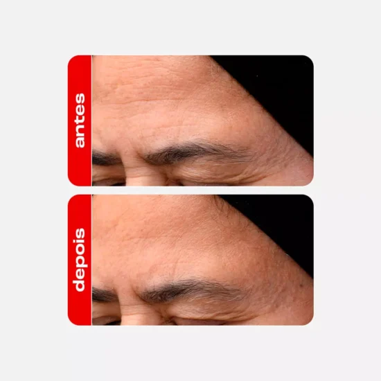 Foto: Divulgação/Creamy - Sérum Facial Retinal Anti-idade